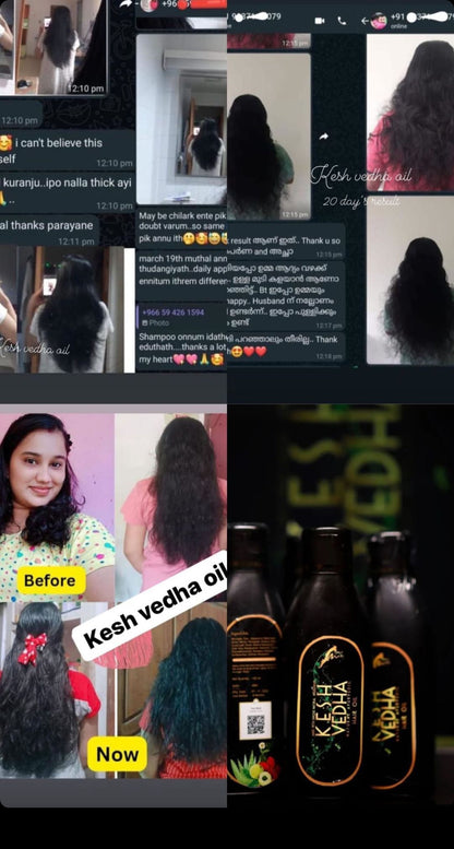KESH  VEDHA HAIROIL